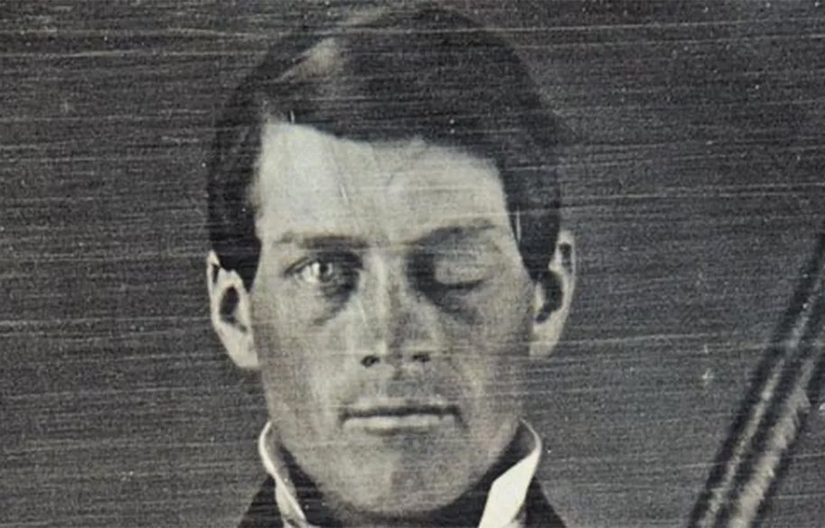 Phineas-Gage