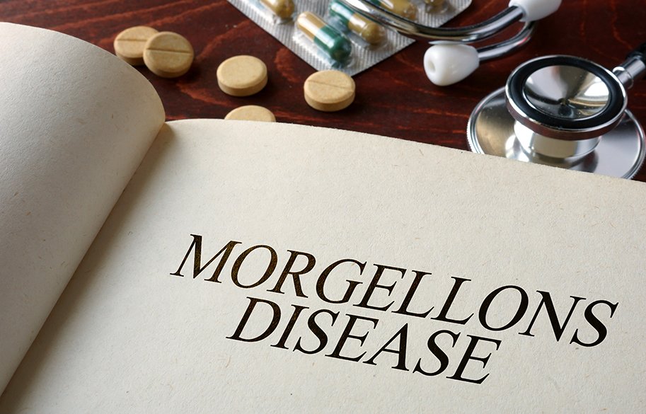 morgellons-disease-conditions-main